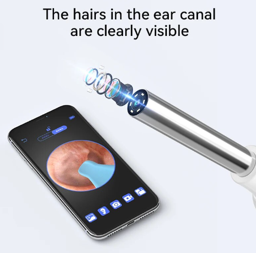 Earsmart ProClean: Smart Earwax Remover