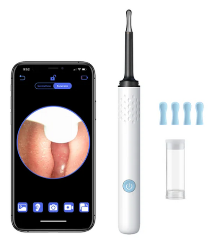 Earsmart ProClean: Smart Earwax Remover