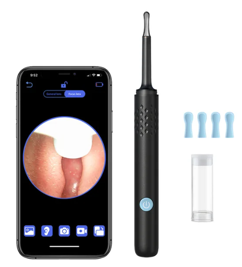 Earsmart ProClean: Smart Earwax Remover