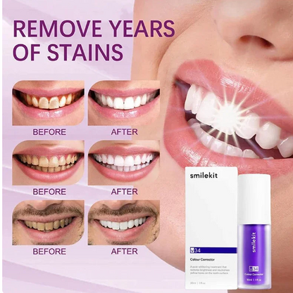 Teeth Whitening Serum